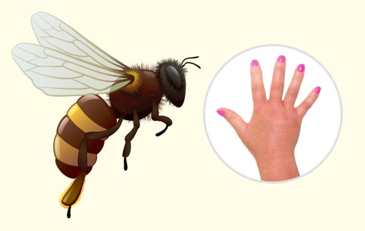 10 Bug Bites Anyone Should Be Able to Identify 3 Usa People 10 Bug Bites Anyone Should Be Able to Identify