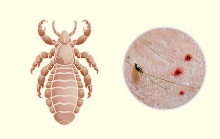 10 Bug Bites Anyone Should Be Able to Identify 11 Usa People 10 Bug Bites Anyone Should Be Able to Identify