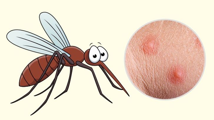 10 Bug Bites Anyone Should Be Able to Identify 6 Usa People 10 Bug Bites Anyone Should Be Able to Identify