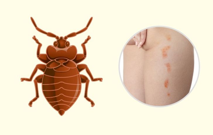10 Bug Bites Anyone Should Be Able to Identify 12 Usa People 10 Bug Bites Anyone Should Be Able to Identify